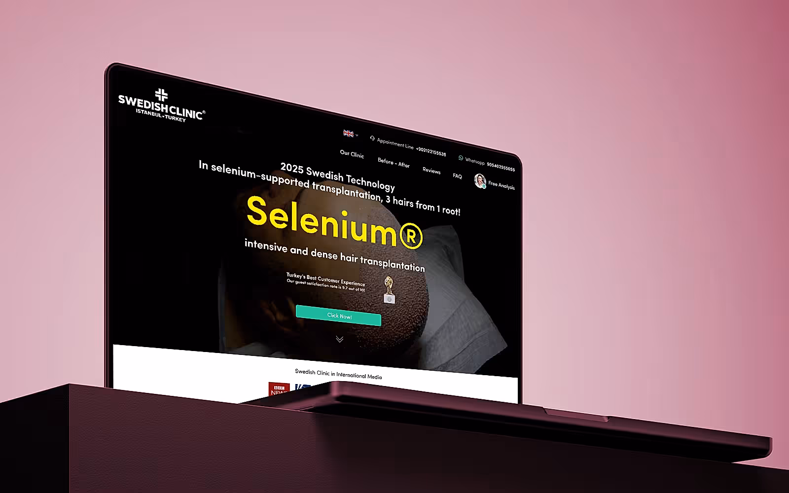 Swedish Clinic (İsveç Klinik) web sitesi WordPress arayüz tasarımı (Swedish Clinic)